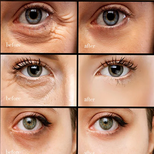 【Black Friday,50 %off,】Caffeine eye cream