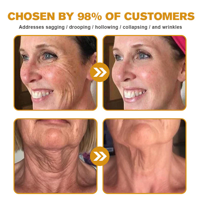 👨‍⚕️👨‍⚕️ Made and Shipped from US✅ Botox Bee Venom Wrinkle Removal Cream- LAST DAY 80% OFF