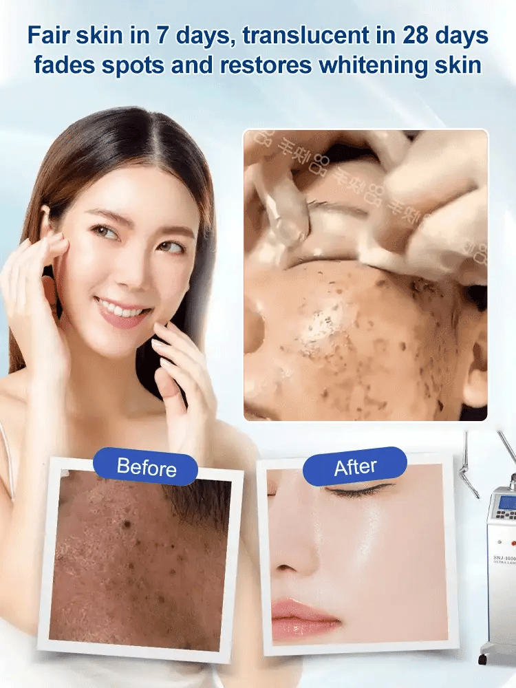 🎁LAST DAY 50% OFF🎁Spot Fading Urea Cream