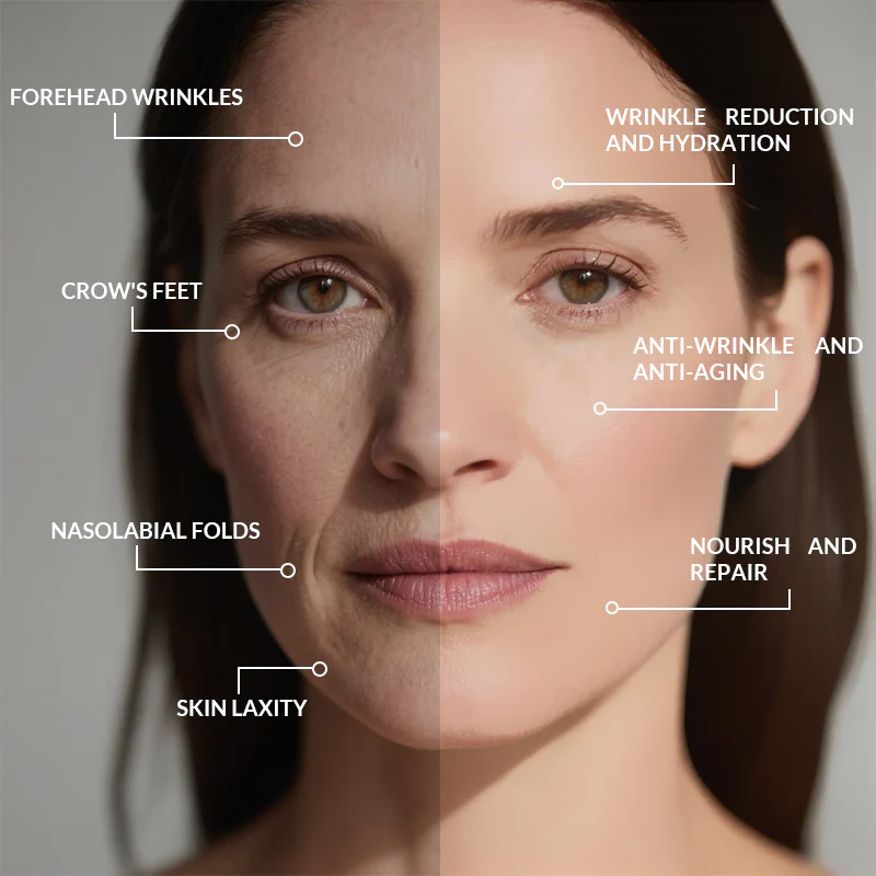 👨‍⚕️QINGLIN Anti-Wrinkle Cream👨‍⚕️