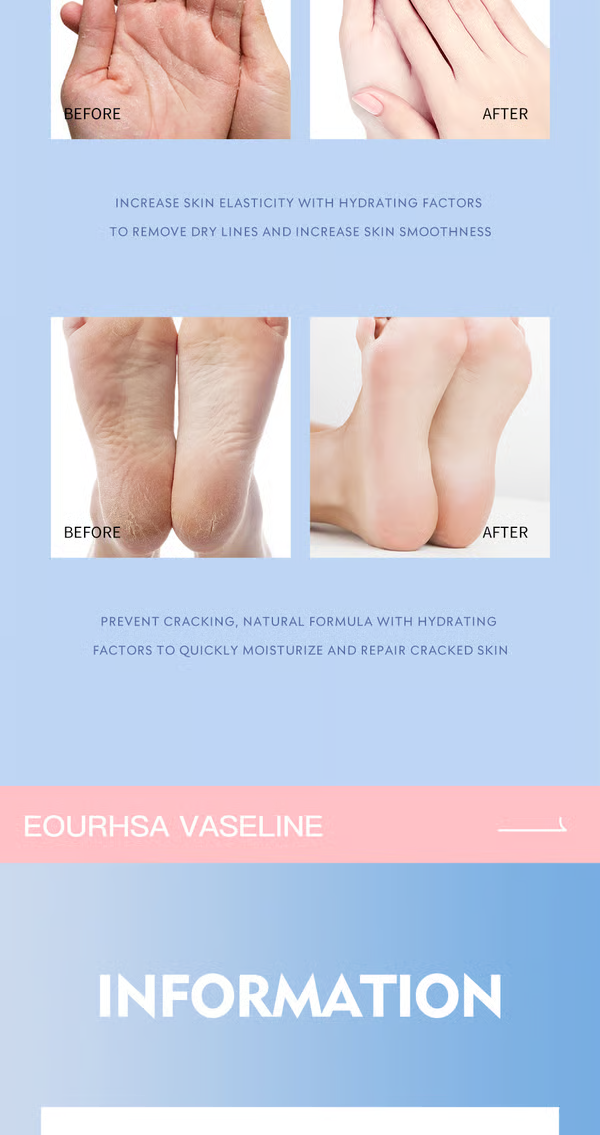 🔥 🔥 Foot Care Cream,Remove Dead Skin and Moisturize Dry Skin