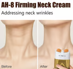 👩🦰 Hot Sale 49% OFF🌿 - Neck Firming Cream