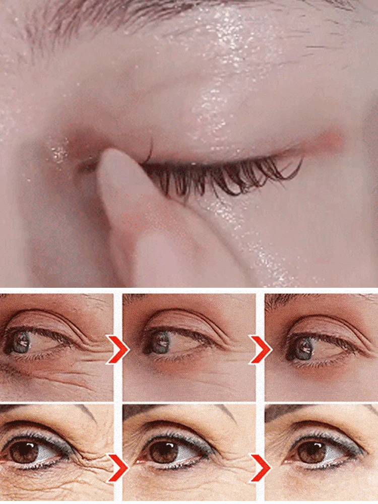 🔥Anti-wrinkle eye serum oil🔥