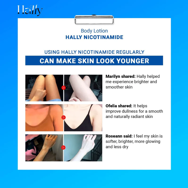🔥Original Hally Niacinamide Whitening Body Lotion🔥
