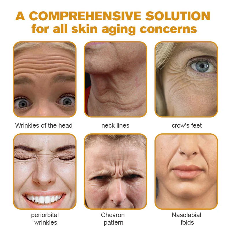 👨‍⚕️👨‍⚕️ Made and Shipped from US✅  Botox Bee Venom Wrinkle Removal Cream- LAST DAY 80% OFF