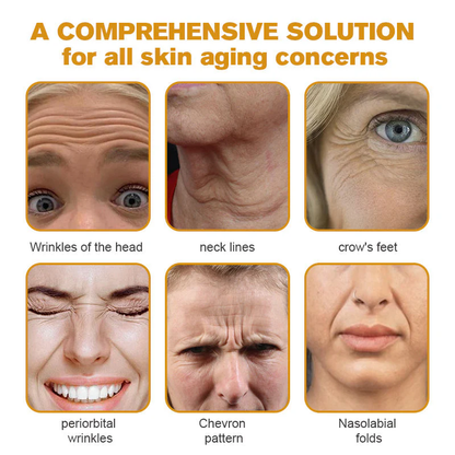 👨‍⚕️👨‍⚕️ Made and Shipped from US✅  Botox Bee Venom Wrinkle Removal Cream- LAST DAY 80% OFF