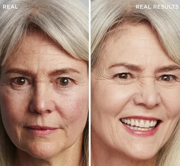 🔥LAST DAY SALE 50% OFF✨⚡ 50K+ SOLD! 🎁4-in-1 Perfecting Foundation – High Coverage, SPF & All-Day Hydration 🤍✨