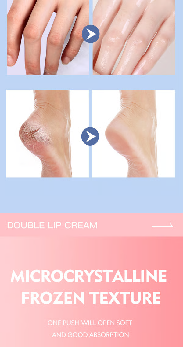 🔥 🔥 Foot Care Cream,Remove Dead Skin and Moisturize Dry Skin