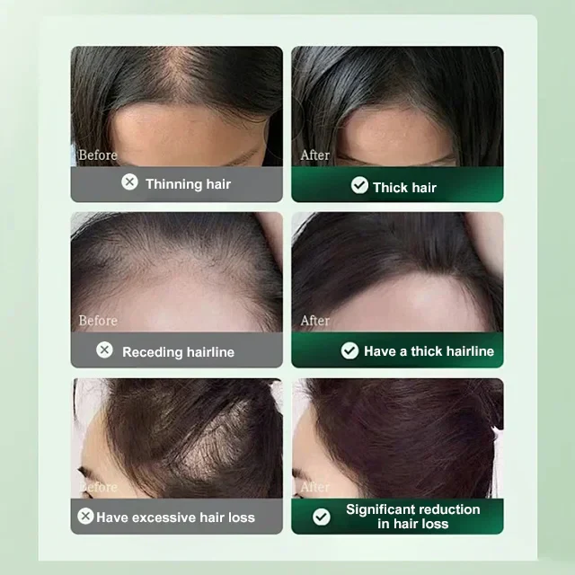 Plant Essence Hair Care and Growth Serum