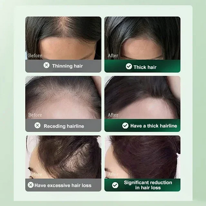 Plant Essence Hair Care and Growth Serum