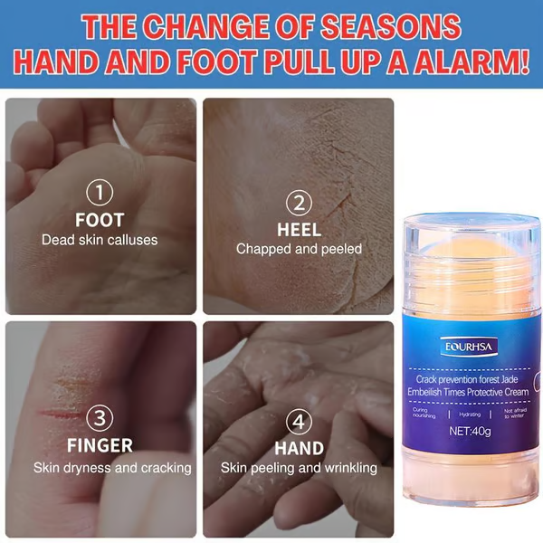 🔥 🔥 Foot Care Cream,Remove Dead Skin and Moisturize Dry Skin